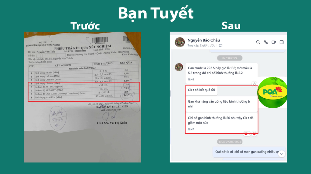 Feedback trước, sau mát gan siro