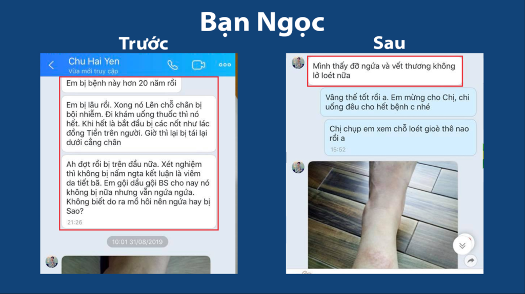 Feedback trước, sau mát gan siro