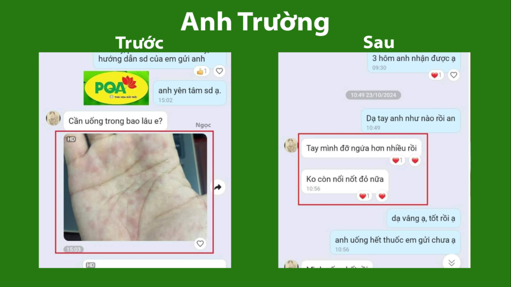 Feedback trước, sau mát gan siro