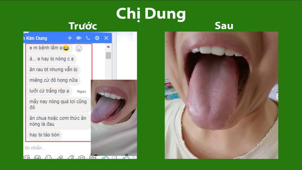 Feedback trước, sau tam hoàng giải độc 1