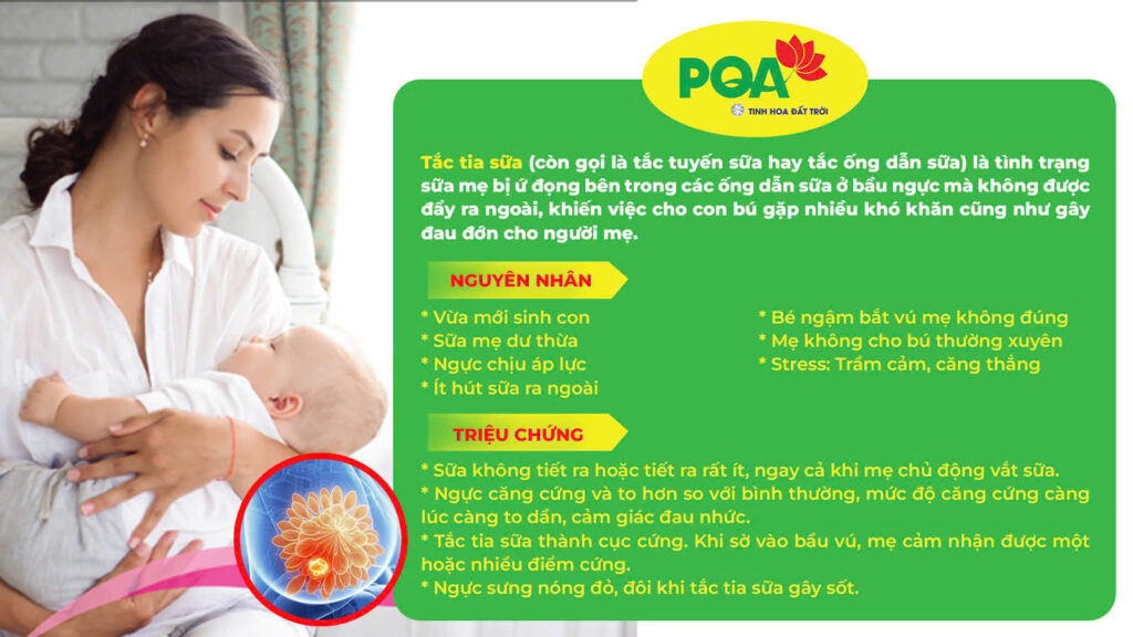 Nguyên nhân và triệu chứng của tắc tia sữa