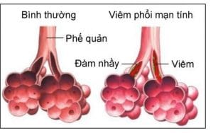 Dược phẩm PQA