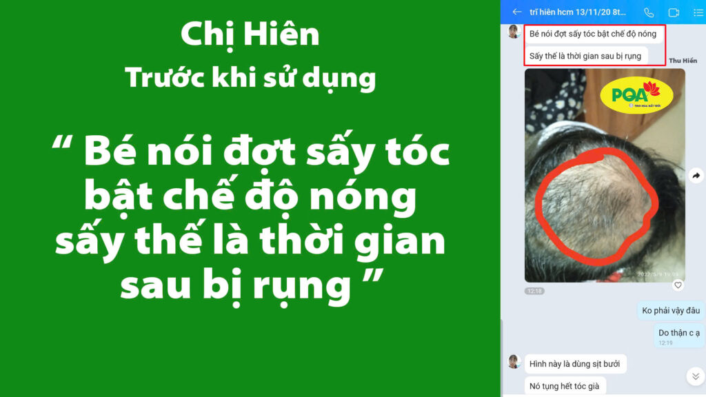 Feedback bổ doanh