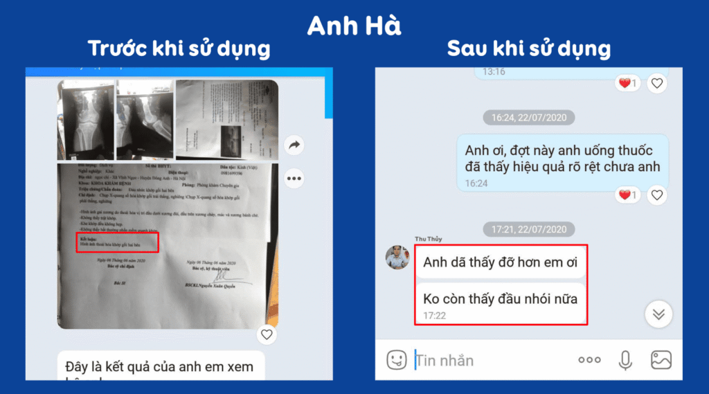 Feedback trước sau hy thiêm