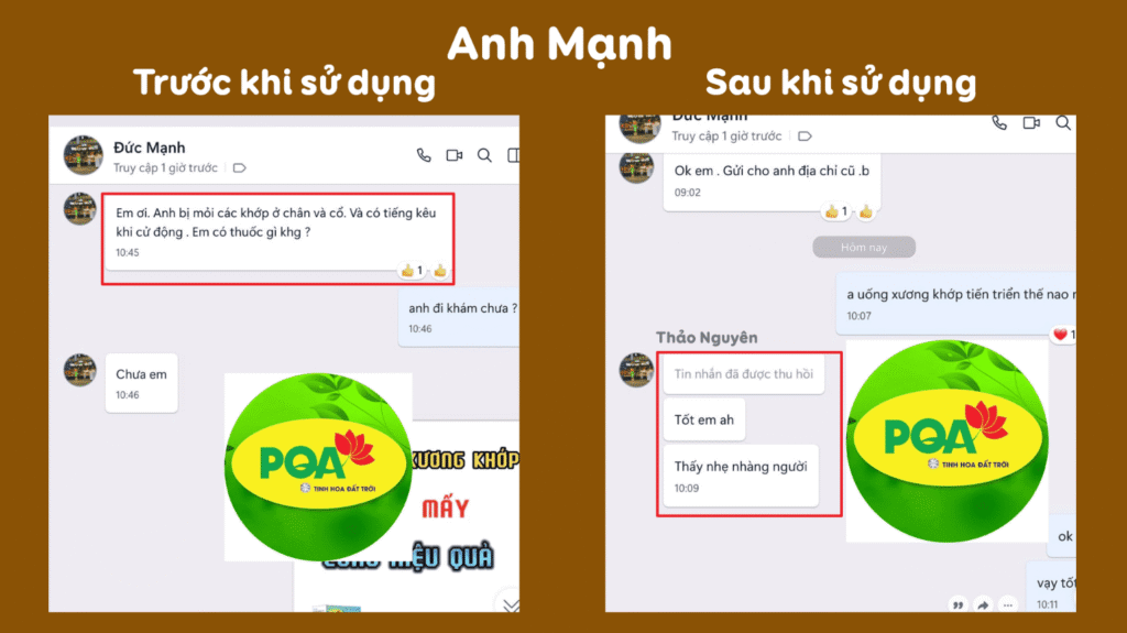 Feedback trước sau xương khớp viên nang 