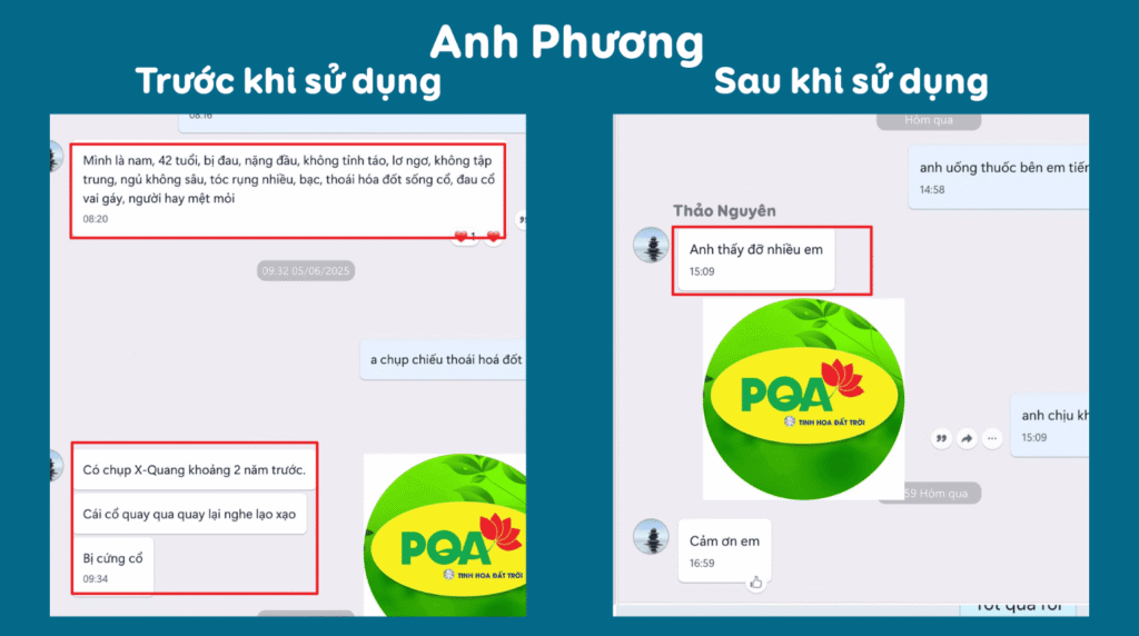 Feedback trước, sau viên nang vai gáy