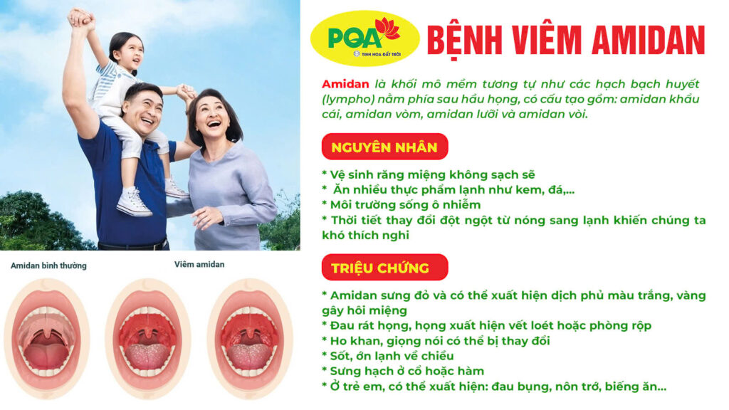Nguyên nhân triệu chứng thuốc amidan