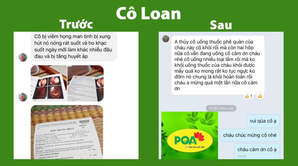 Feedback phế quản viên nang