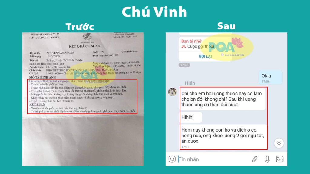 Feedback trước, sau hoàng kim 