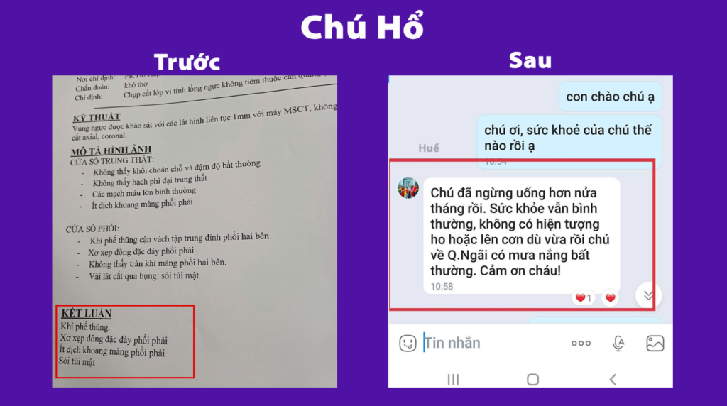 Feedback trước, sau hoàng kim 