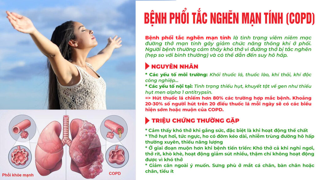 Nguyên nhân triệu chứng hoàng kim