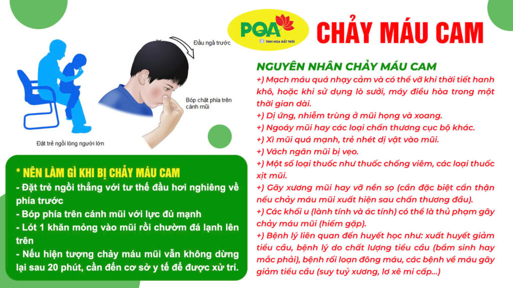Nguyên nhân gây nên chảy máu cam
