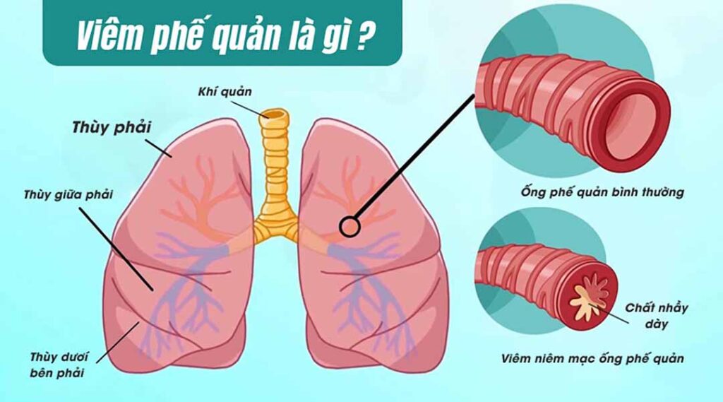 Dược phẩm PQA
