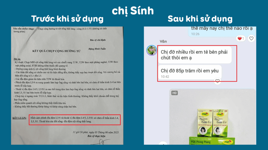 Feedback trước sau phòng phong