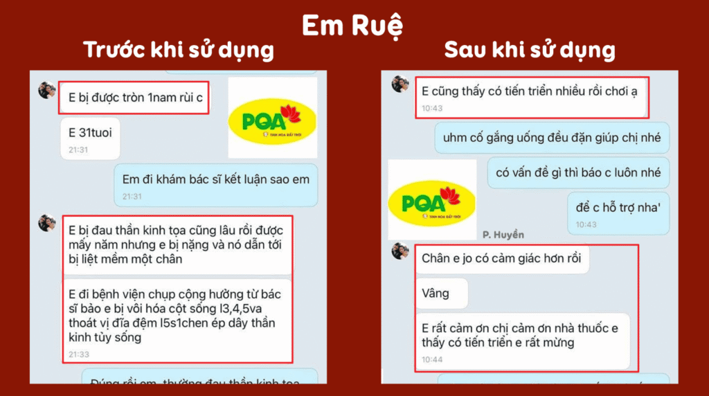 Feedback trước sau phòng phong