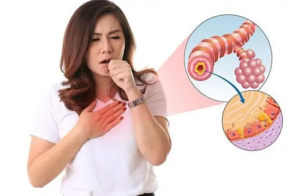 người bị viêm phế quản 