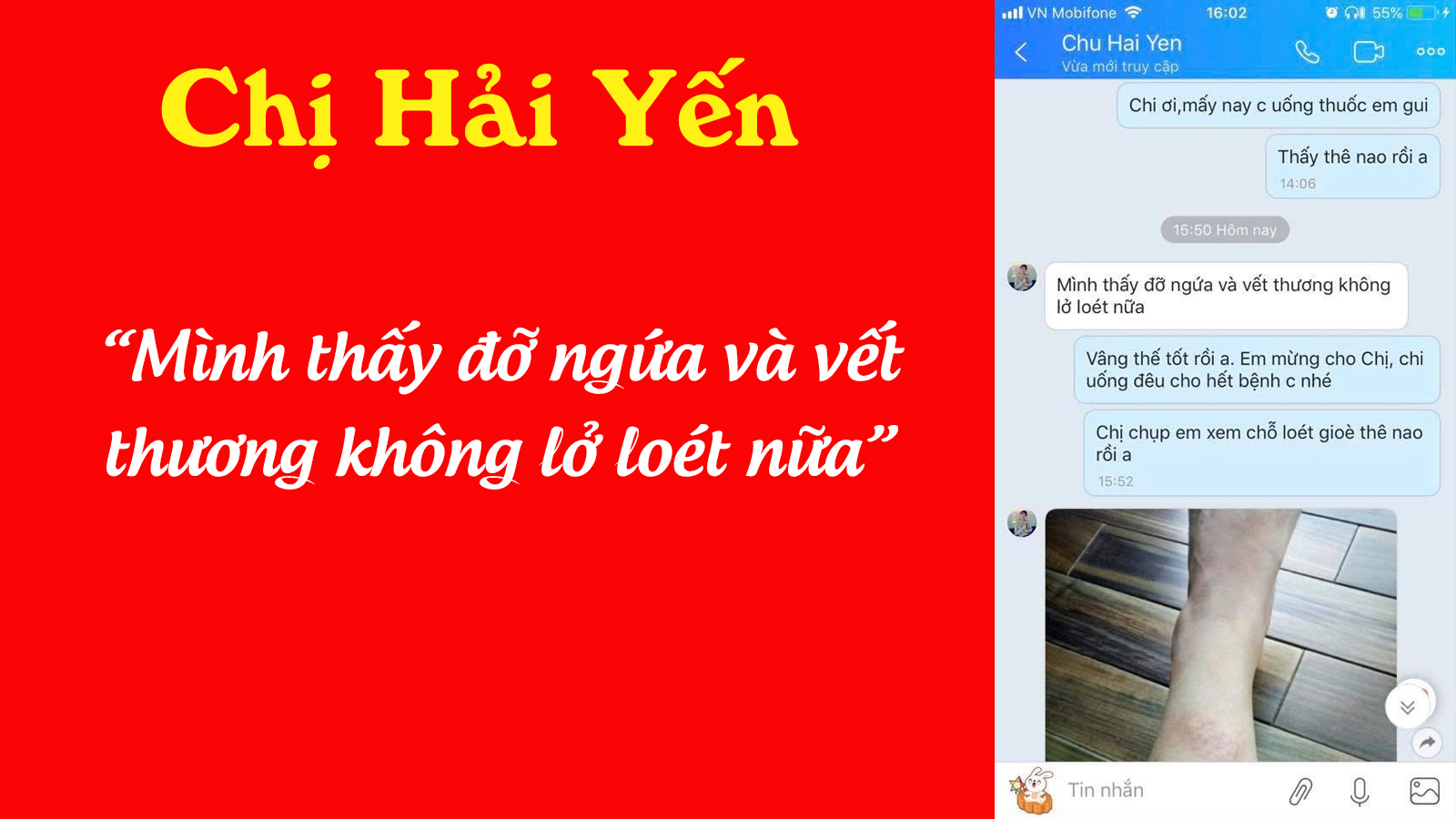 Bổ gan