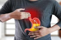 trào ngược dạ dày