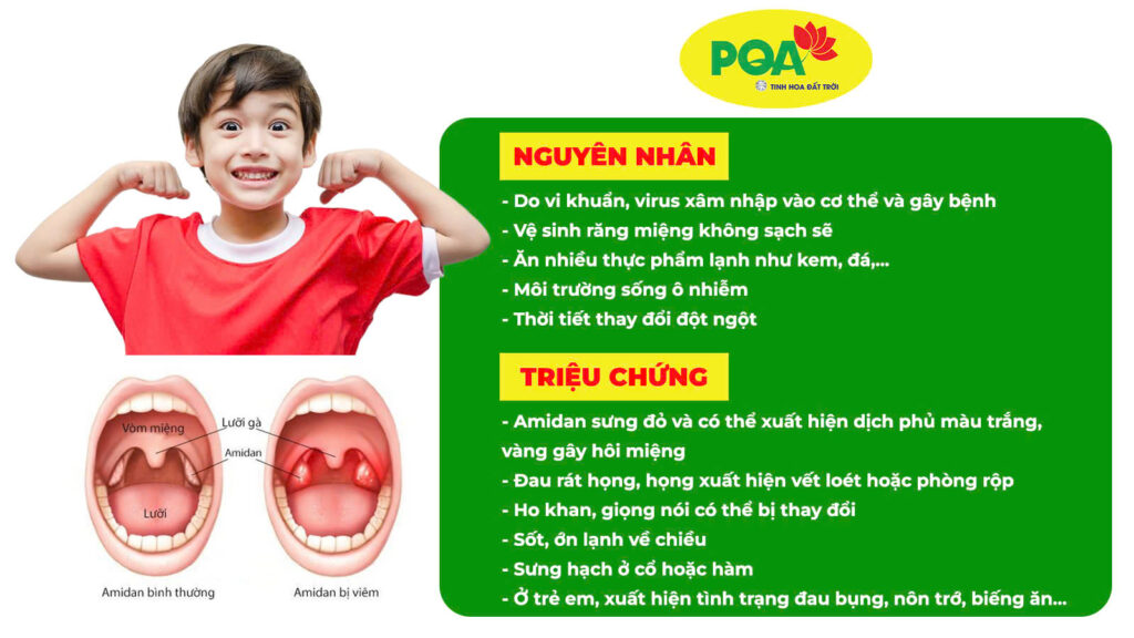 Nguyên nhân và triệu chứng Amidan