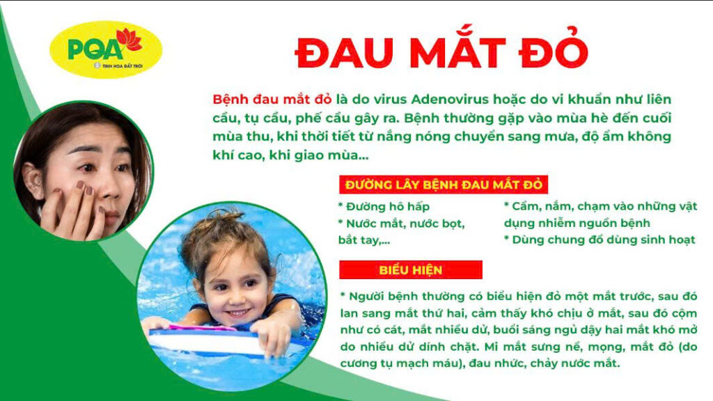 Nguyên nhân và triệu chứng kim ngân hoa