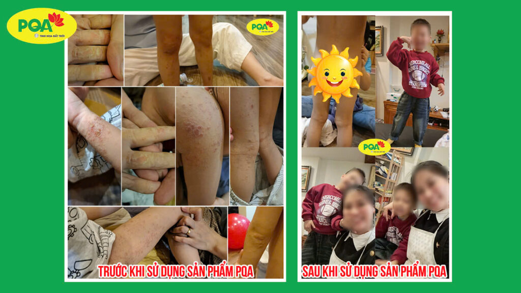 Feedback Kim Ngân Phong