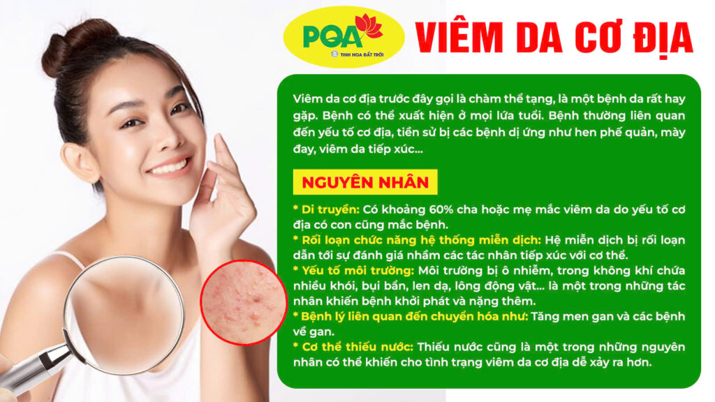 Nguyên nhân và triệu chứng của viêm da cơ địa