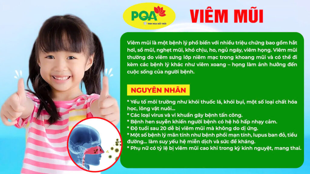 Nguyên nhân và triệu chứng viêm mũi
