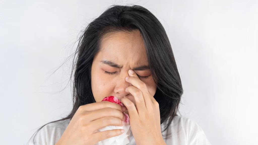 chảy máu cam