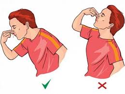 làm gì khi bị chảy máu cam