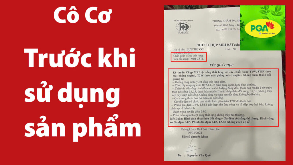 Feedback Xương Khớp