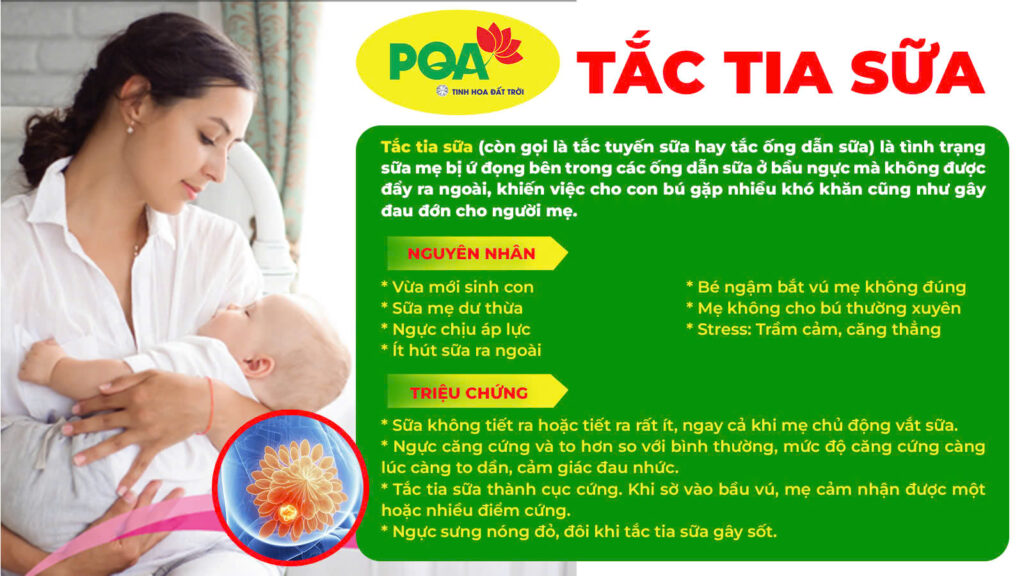 Nguyên nhân và triệu chứng của tắc tia sữa