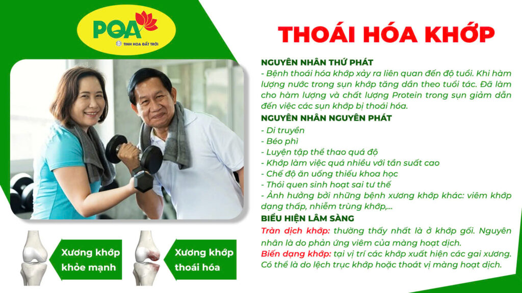 Nguyên nhân và triệu chứng Thoái hoá khớp