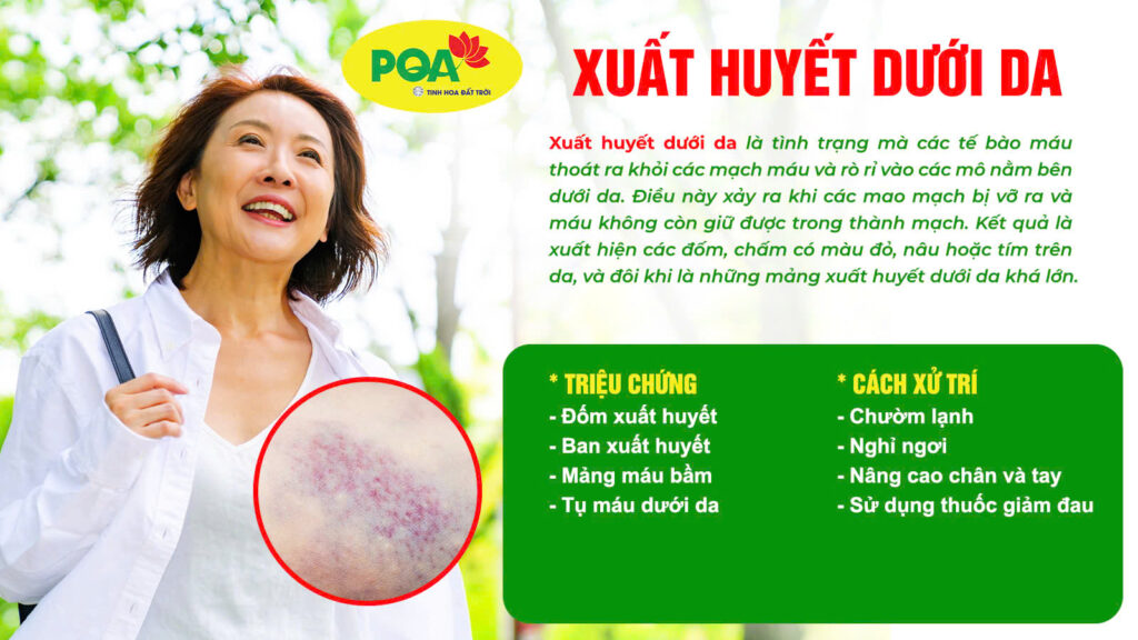 Nguyên nhân và triệu chứng xuất huyết dưới da