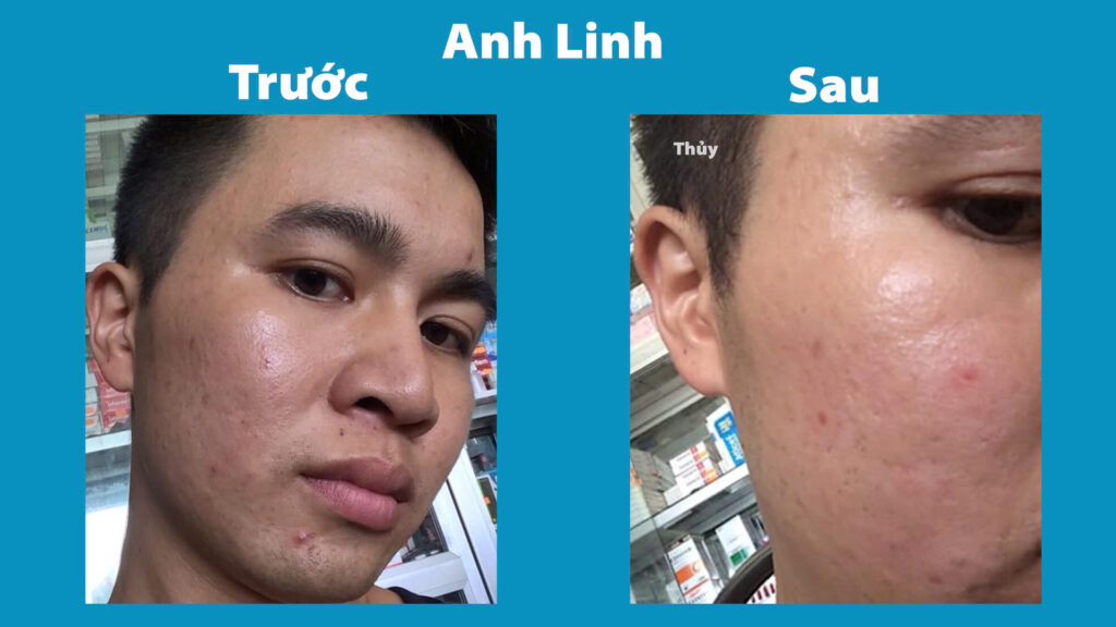 Feedback Hoàng ngân kiều 