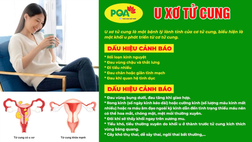 Nguyên nhân triệu chứng trinh nữ hoàng cung