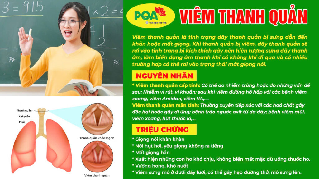 Nguyên nhân và triệu chứng thanh quản