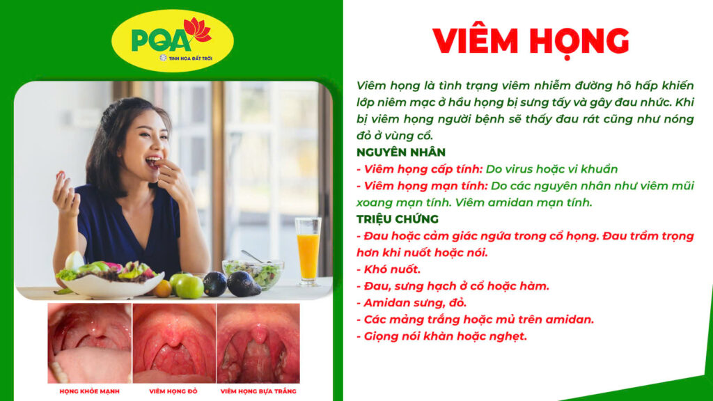 Nguyên nhân và triệu chứng viêm họng