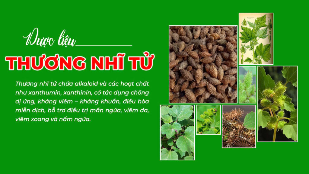 Câu chuyện nga trưởng phong