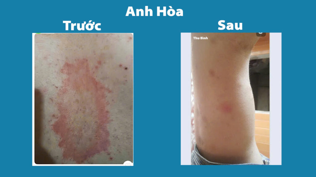 Feedback Nga trưởng phong