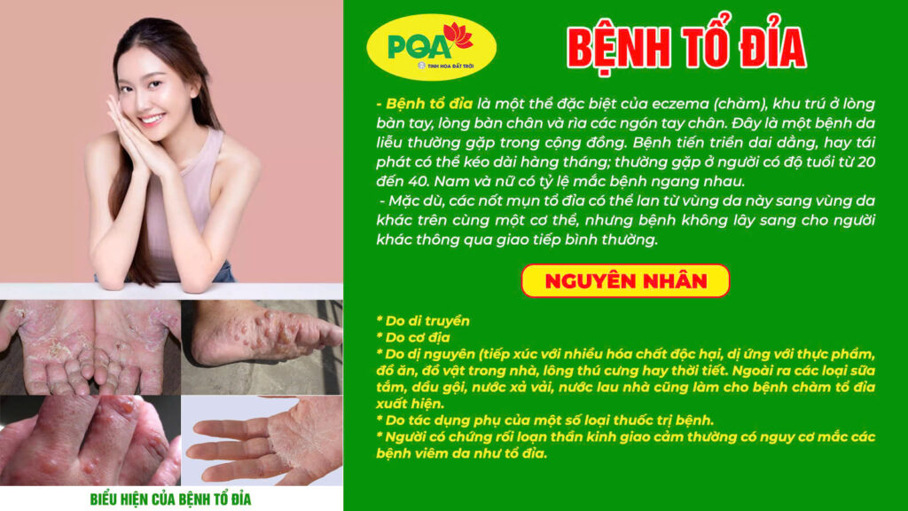 Nguyên nhân triệu chứn nga trưởng phong