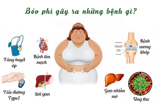 béo phì gây ra những bệnh gì
