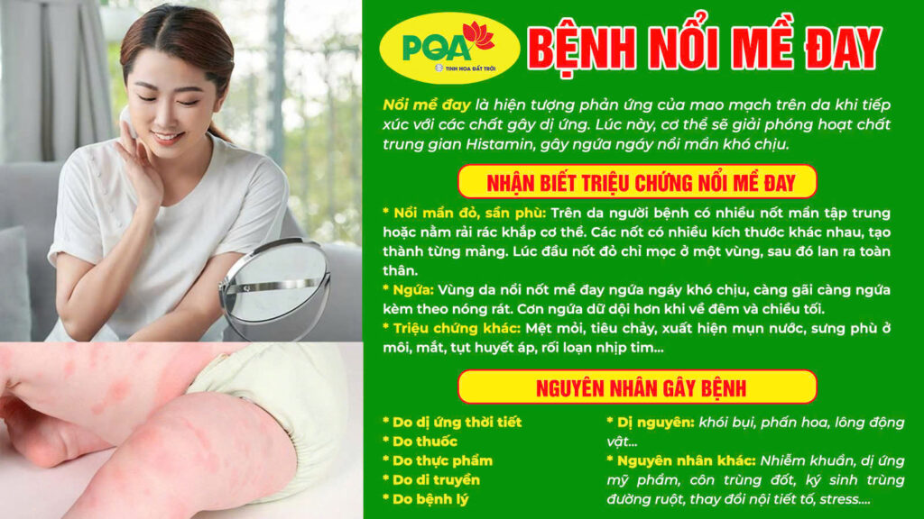 Nguyên nhân triệu chứng trúc diệp