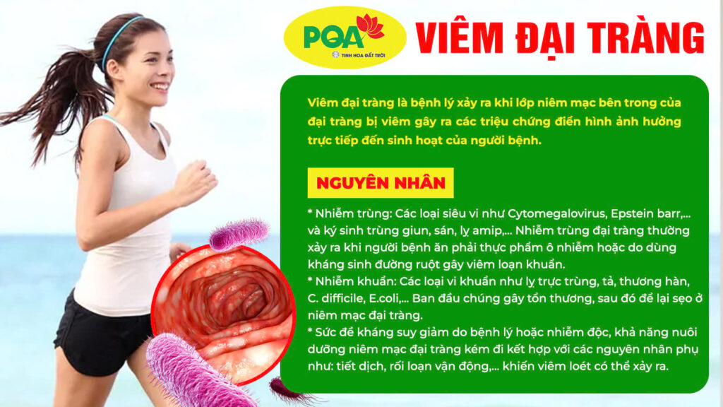 Nguyên nhân bệnh viêm đại tràng