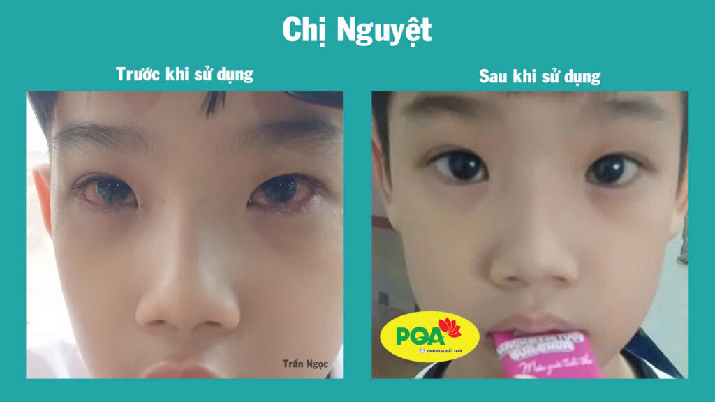 Dược phẩm PQA